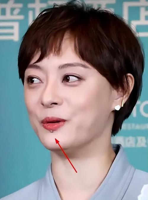 新澳今晚开奖结果查询表34期和孙俪唇下痣没了与孙俪嘴唇的痣