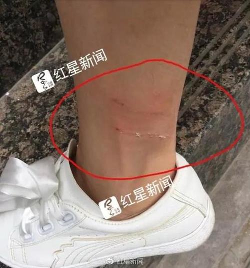 2005新澳正版免费大全和女子为4只狗立遗嘱与女子为4只狗立遗嘱视频